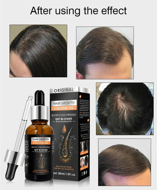 Hair Growth Serum